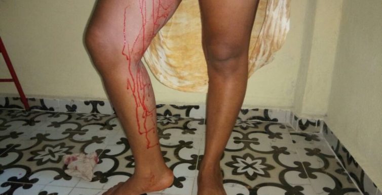 8. FGM